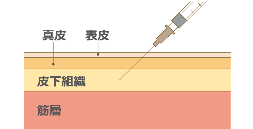 レベスティブの作用